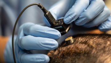 Las conexiones neuronales son vitales y ya tenemos la solución para cuando algo falla: un «biocable» para el cerebro