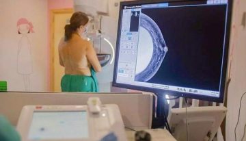 Sanidad amplía el cribado de cáncer de mama a mujeres jóvenes y mayores, el nuevo rango es entre 45 y 74 años