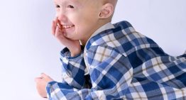 Seis claves de la progeria, la enfermedad ultrarrara que sufre la niña Alexandra Peraut y que provoca vejez prematura