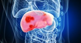 Los médicos alertan de la rápida progresión de la hepatitis Delta y de su relación con el cáncer de hígado