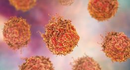 CRIS Contra el Cáncer financia una investigación pionera para entender el cáncer de próstata agresivo en hombres jóvenes
