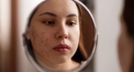 El estrés, las dietas y las rutinas cosméticas disparan el acné entre las mujeres jóvenes: «Me veo y quiero llorar»