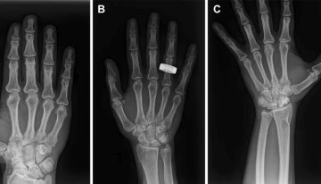 Un grupo de astronautas sin formación médica se ha hecho la primera radiografía en órbita del mundo: es un avance brutal