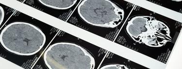 No es solo cuestión de cumplir años: la mala salud metabólica envejece tu cerebro por una vía completamente independiente