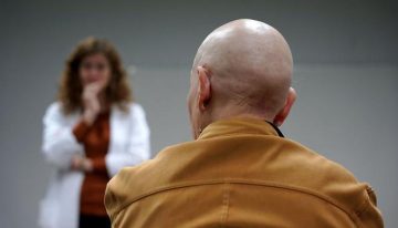 Upadacitinib, así es el nuevo tratamiento para la alopecia areata grave en adultos y adolescentes