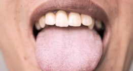 ¿Cuánto hace que no miras tu lengua? Puede revelar más sobre tu salud de lo que imaginas