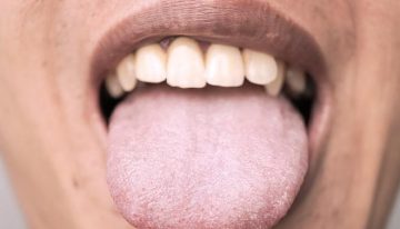 ¿Cuánto hace que no miras tu lengua? Puede revelar más sobre tu salud de lo que imaginas