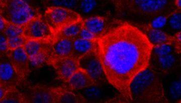 EEUU aprueba Rasonque, una píldora que duplica la supervivencia de pacientes con la forma más común de cáncer de páncreas