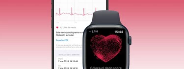Cómo hacerte un electrocardiograma con tu Apple Watch