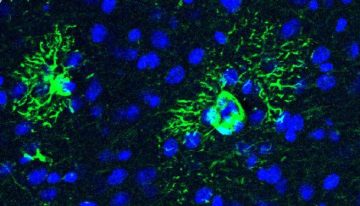 Posible nueva diana contra el alzhéimer: el CSIC descubre una proteína que contribuye al deterioro inicial