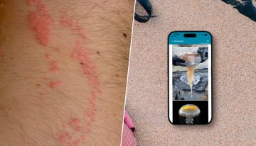 Una picadura de medusa arruinó mis vacaciones. Me prometí que no volvería a pasar y ahora siempre llevo esta app en mi iPhone