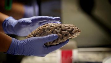 Un equipo de Sant Pau identifica un biomarcador para predecir la progresión del alzhéimer incluso en fases iniciales