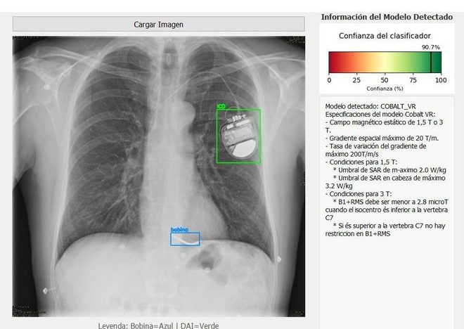 Una IA predice cómo ajustar la resonancia magnética al marcapasos del paciente para que no deje de funcionar
