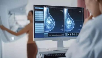 Las terapias dirigidas abren un nuevo horizonte en el cáncer de mama metastásico, el más grave y avanzado