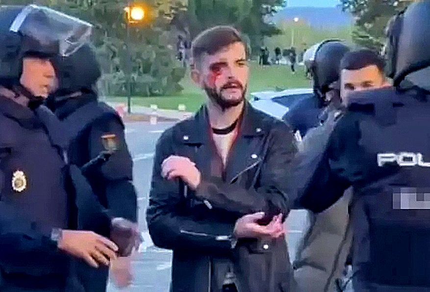 El periodista agredido, José Ismael Martínez.