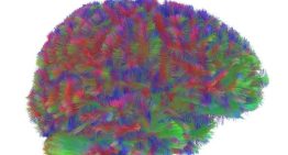 El cerebro pasa por cinco fases en la vida, que cambian a los 9, 32, 66 y 83 años