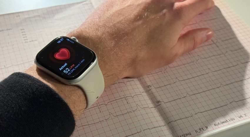 El 57% de los pacientes se sentían bien. El Apple Watch descubrió un problema grave que los chequeos médicos pasaron por alto