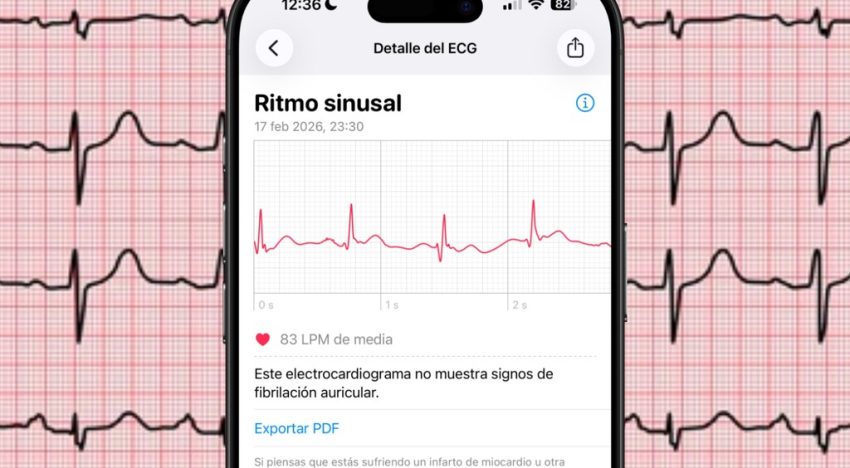 El truco para exportar un ECG del Apple Watch en un PDF. Se puede incluso imprimir para llevarlo al médico