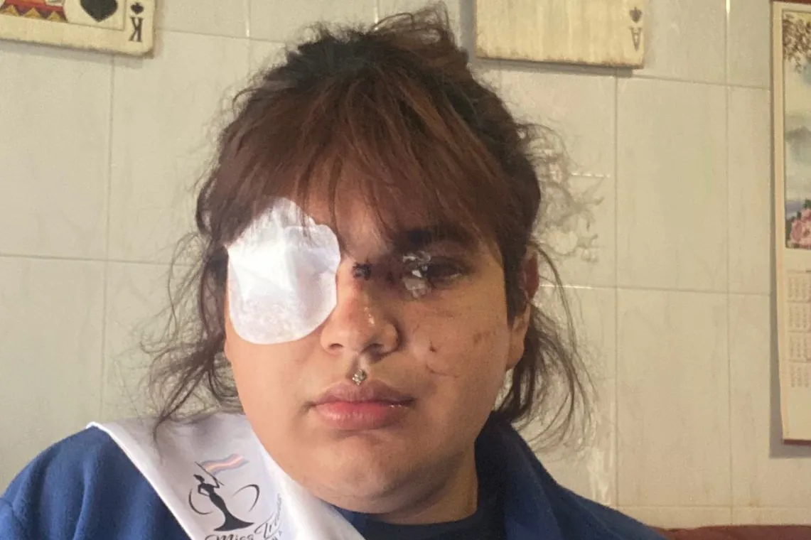 Bianca, Miss Trans Zamora, tras la agresión: «Está todavía con mucho miedo, porque hubo un momento en que se vio muerta»
