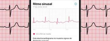Hay una forma de convertir los electrocardiogramas del Apple Watch en un PDF. Y se tarda menos de un minuto