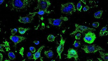 AP-2, así es el fármaco contra la ELA que podría ralentizar la enfermedad: «Obtuvimos resultados prometedores»