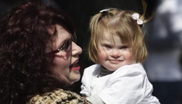 Casi la mitad de los bebés con síndrome de Down nacen con una cardiopatía congénita: «La clave es operarles pronto»