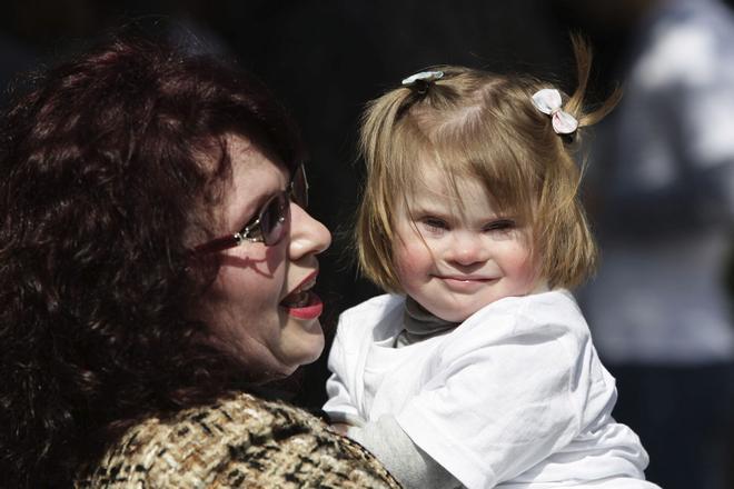 Casi la mitad de los bebés con síndrome de Down nacen con una cardiopatía congénita: «La clave es operarles pronto»