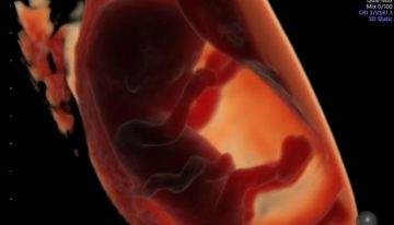 Un consumo excesivo de ultraprocesados podría perjudicar la fertilidad de los padres y el desarrollo embrionario de los bebés