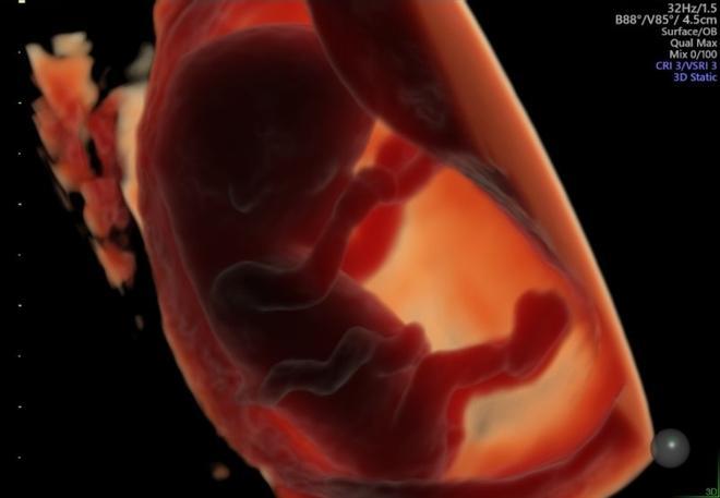 Un consumo excesivo de ultraprocesados podría perjudicar la fertilidad de los padres y el desarrollo embrionario de los bebés