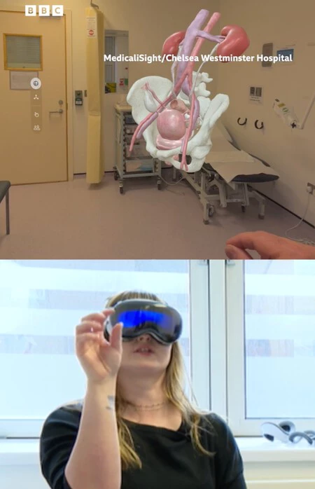 Hospital Vision Pro