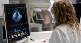 El 20% de los diagnósticos de cáncer de mama son en realidad lesiones precancerosas: «Se trata innecesariamente a un número muy alto de mujeres»