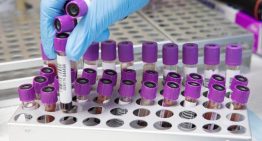 Un análisis de sangre con inteligencia artificial abre la puerta al diagnóstico precoz de la lepra