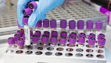 Un análisis de sangre con inteligencia artificial abre la puerta al diagnóstico precoz de la lepra