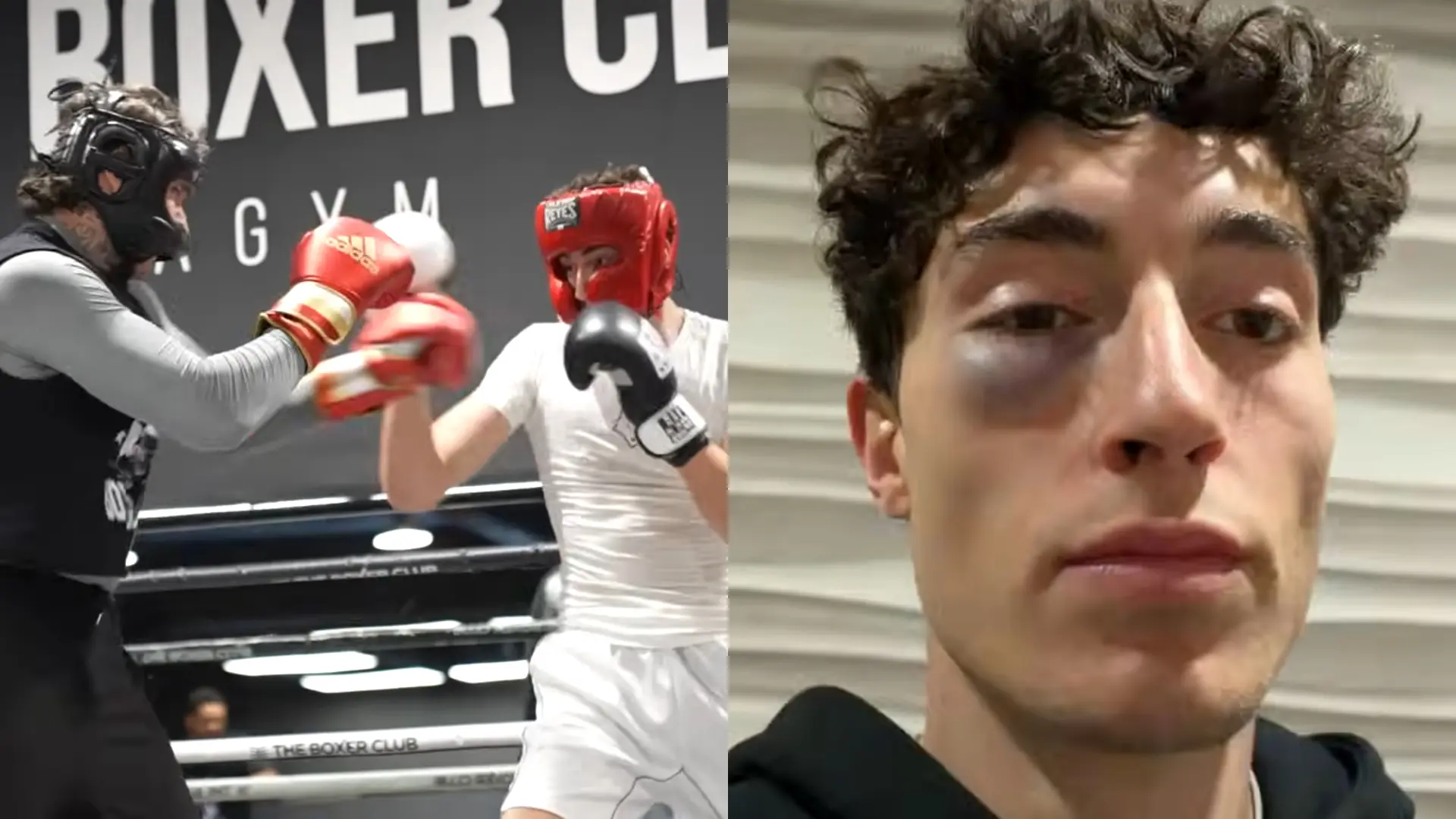 Plex, con el ojo morado tras protagonizar un sangriento 'sparring' antes de 'La Velada del año 6': «Todas las culpas a Ibai»