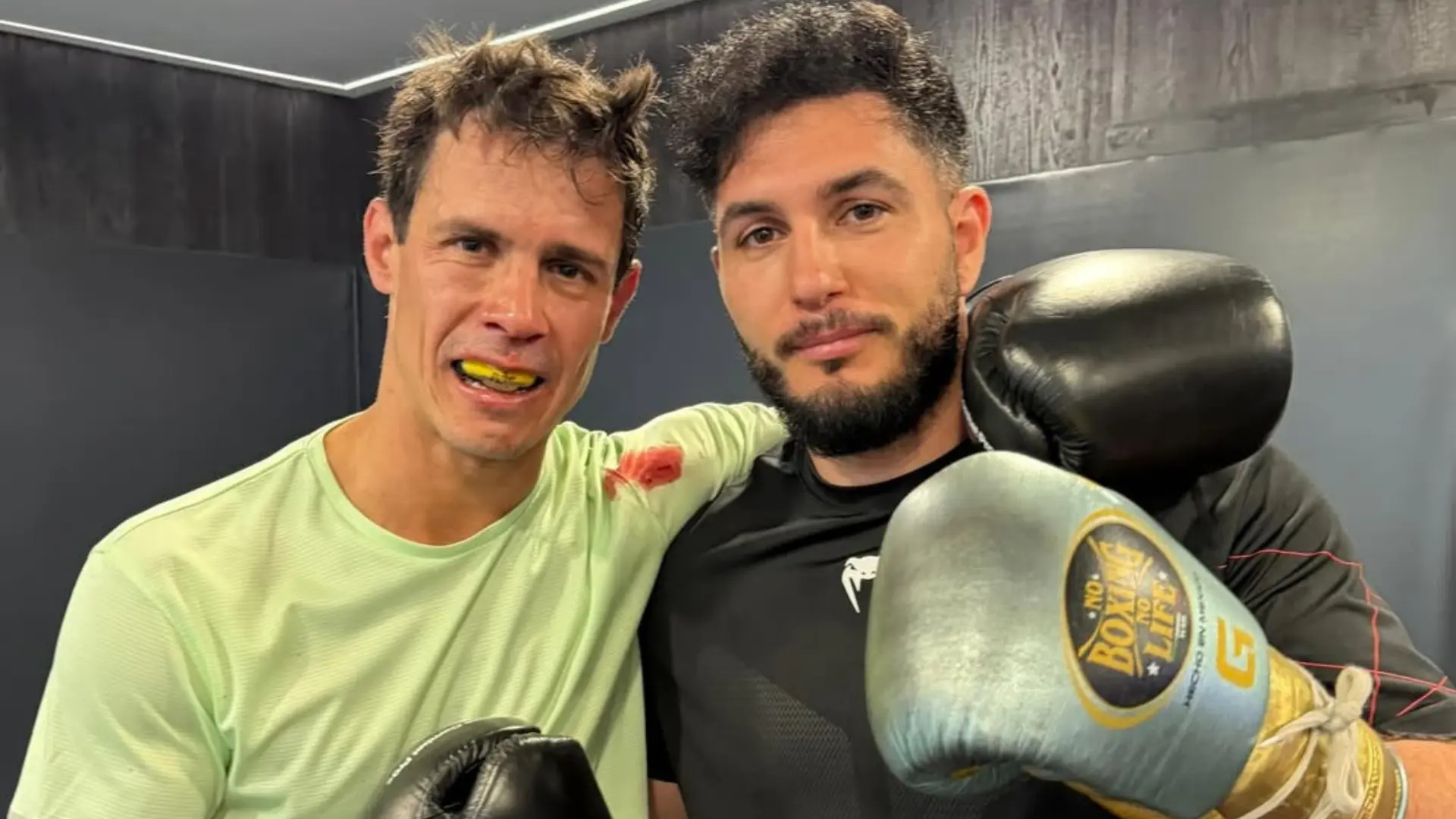 Edu Aguirre acaba en el hospital tras hacer sparring con Omar Montes para La Velada: «Me preocupa si tengo el tabique desviado»