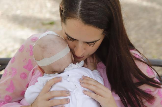 Un bebé con espina bífida severa supera una intervención fetal y regresa al hogar familiar: «Su risa lo cambia todo»