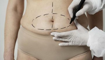 Una tercera mujer denuncia al cirujano plástico de Murcia en prisión por agresión sexual