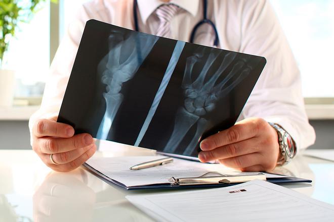 ¿Sabías que tus huesos están vivos y se renuevan constantemente? Descubre los secretos de tu esqueleto