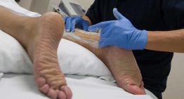 Un equipo médico de Barcelona regenera el tendón de Aquiles sin cirugía mediante células madre cultivadas: «Permite al paciente andar sin yesos ni férulas»