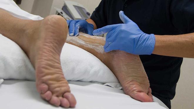 Un equipo médico de Barcelona regenera el tendón de Aquiles sin cirugía mediante células madre cultivadas: «Permite al paciente andar sin yesos ni férulas»