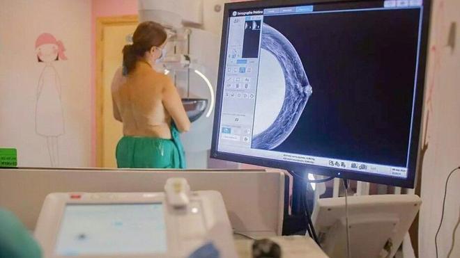 Sanidad amplía el cribado de cáncer de mama a mujeres jóvenes y mayores, el nuevo rango es entre 45 y 74 años