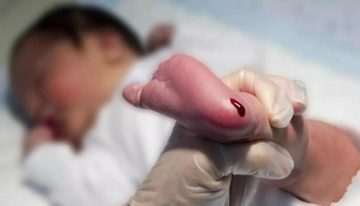 España incorpora el cribado neonatal para el síndrome de los 'niños burbuja' en el que Catalunya fue pionera
