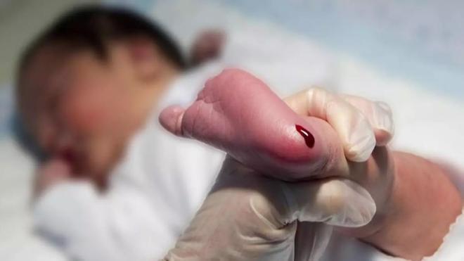 España incorpora el cribado neonatal para el síndrome de los 'niños burbuja' en el que Catalunya fue pionera