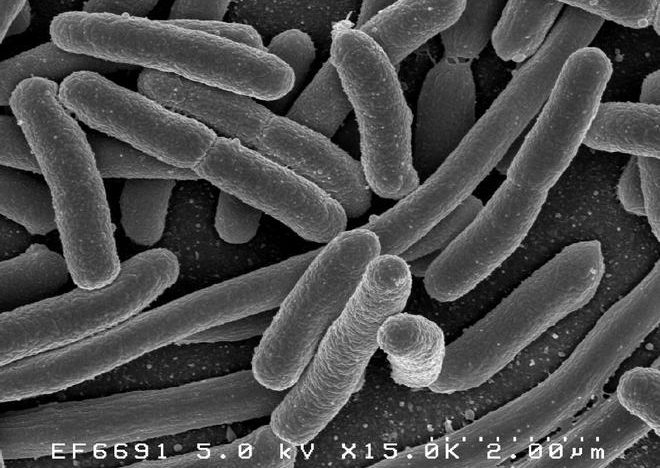 Más de 24.000 personas mueren al año en España por bacterias resistentes a antibióticos
