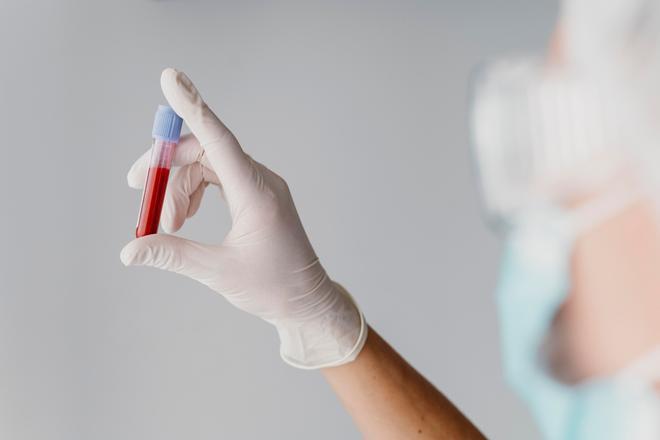 España aprueba la financiación de dos indicaciones de glofitamab, una terapia para un tipo de linfoma agresivo y de crecimiento rápido