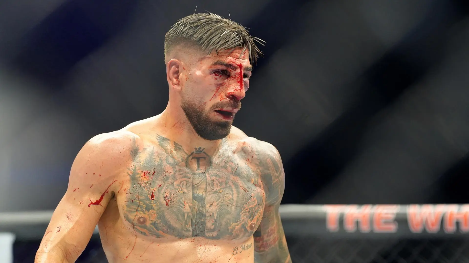 Primeras palabras de Ilia Topuria tras su derrota ante Gaethje: «Dijiste que dejarías tu marca en mi rostro… y lo hiciste»
