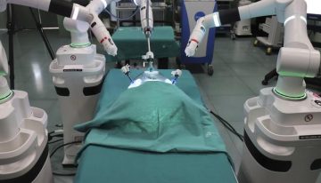 Realizado con éxito el primer trasplante simultáneo de intestino y páncreas en España