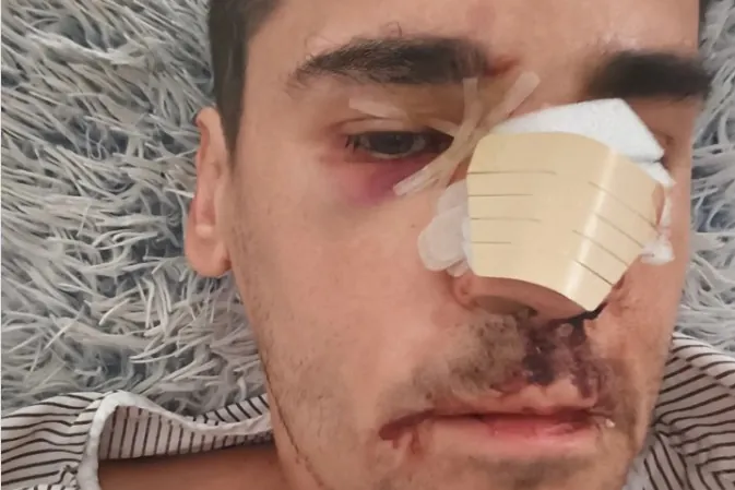 El periodista Fonsi Loaiza denuncia una «brutal agresión»: «Lo último que recuerdo es que me llamaron 'rojo, subcampeón' antes de quedar inconsciente»