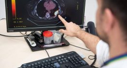 Un estudio apunta a que la vitamina D ayuda a la recuperación de los pacientes tras un ictus