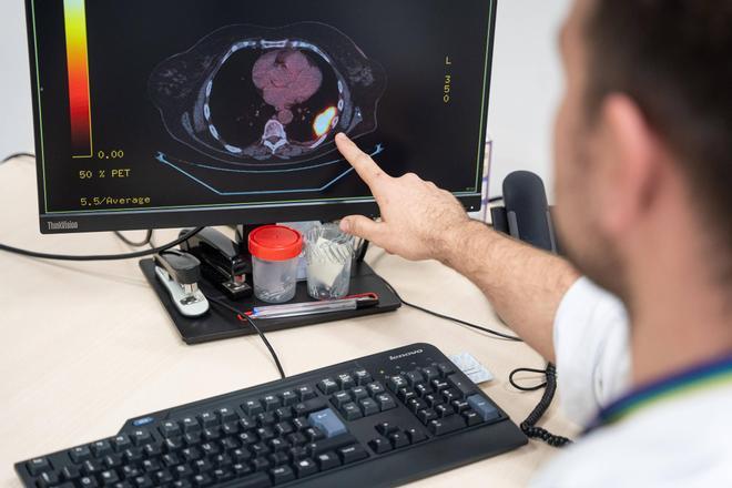 Un estudio apunta a que la vitamina D ayuda a la recuperación de los pacientes tras un ictus